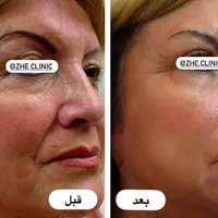 پی آر پی (جشنواره)فقط 690|خدمات آرایشگری و زیبایی|مشهد, طلاب|دیوار