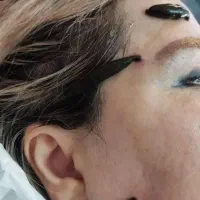 حجامت/بادکش/زالو/ناف گیر/ماساژدرمانی درمنـزل شـما|خدمات آرایشگری و زیبایی|کرمانشاه, |دیوار