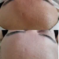 ۵۰درصدتخفیف پاکسازی صورت و بدن