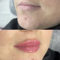 جشنواره تخفیف ویژه فیلربوتاکس انزیم وقت فوری|خدمات آرایشگری و زیبایی|کرج, گوهردشت|دیوار