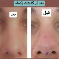آموزش و خدمات ژل و بوتاکس|خدمات آرایشگری و زیبایی|زابل, |دیوار