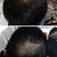 این افراد فقط توی 65روز به این نتیجه رسیدن