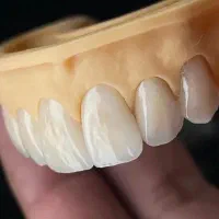 دندانپزشکی اقساطی با تعرفه مناسب|خدمات آرایشگری و زیبایی|هشتگرد, شهرک ولیعصر (مصلی)|دیوار