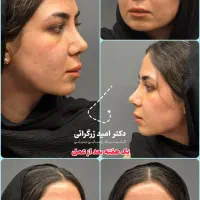 مشاوره تخصصی و رایگان عمل بینی|خدمات زیبایی و سلامت|شیراز, ستارخان|دیوار
