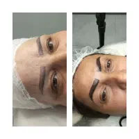 میکروبلیدینگ تغییررنگ تیره به روشن  وبوتاکس۴۵۰|خدمات آرایشگری و زیبایی|رشت, باهنر|دیوار