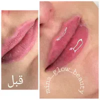 آموزش  و ارائه  ژل و بوتاکس و مزو|خدمات آموزشی|شیراز, سینما سعدی|دیوار