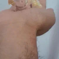 کوتوله برزیلی سرلاکی
