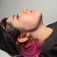 زاویه سازی فک و غبغب