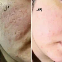 روشن کننده ۳۹۹|آرایشی، بهداشتی، درمانی|جیرفت, |دیوار