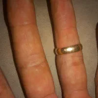 حلقه