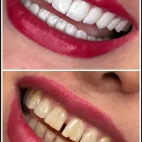 تخفیفات قربان تا غدیر دندانپزشکی
