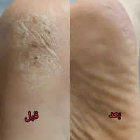 پدیکور خشک و پاکسازی صورت بانوان|خدمات آرایشگری و زیبایی|رشت, معلم|دیوار