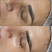 فیشیال تخصصی پوست