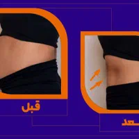 لاغری موضعی بدون جراحی و رژیم سخت|خدمات آرایشگری و زیبایی|اصفهان, سعادت‌آباد|دیوار