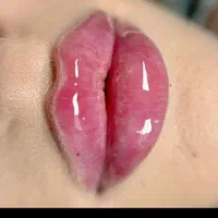(کلینیک دنا)  فیلر لب ژل‌لب ،زاویه سازی ،طبیعی|خدمات آرایشگری و زیبایی|یاسوج, |دیوار