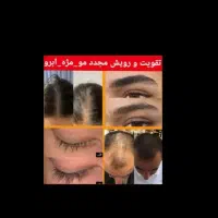 محلول مو و ابرو ،ریش مژه|آرایشی، بهداشتی، درمانی|قم, دورشهر|دیوار
