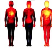 .تنظیم دمای کل بدن سردی و گرمی دست و پا