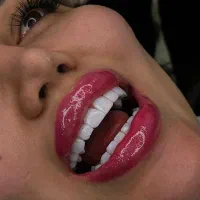 کامپوزیت ۸۰٪تخفیف(فکی۵تومن،تکنیک لیرینگ رایگان)