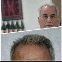 سلامت مو با قدرت طبیعت