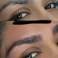 میکروبلیدینگ کرکی مویی ابرو