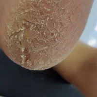 * پدیکور تخصصی دلارا. *