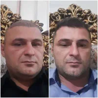 کاشتموپرتراکم برای اهل بانه بااقساط وهتل رایگان