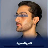 فیلر بادی ژل لب بوتاکس نخ لیفت فیلر بینی آنزیم لب|خدمات آرایشگری و زیبایی|اصفهان, باغ نگاره|دیوار