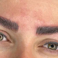 نانو بروز (میکروبلیدینگ )