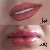 انجام خدمات ژل و بوتاکس|خدمات آرایشگری و زیبایی|اسلامشهر, شهرک مصطفی خمینی|دیوار