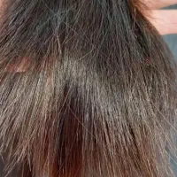 موخوره گیری