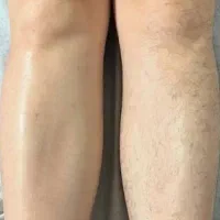 اپیلاسیون تخصصی بانوان