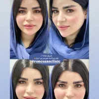 انجام کارهای زیبایی درمطب پزشک