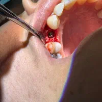 مطب دندانپزشکی بیمه ملت (شهرداری)|خدمات آرایشگری و زیبایی|ارومیه, |دیوار