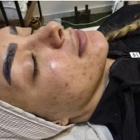 آموزش تخصصی فیشال و پاکسازی پوست|خدمات آموزشی|ارومیه, |دیوار