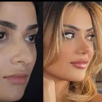 عمل جراحی بینی وترمیم باپیزو/لیفت صورت وپلک|خدمات آرایشگری و زیبایی|کرج, چهارصد دستگاه|دیوار