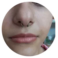 تزریق ژل وبوتاکس به روشM.پیرسینگ.خال برداری