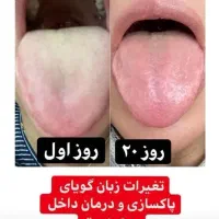 معجزه پاکسازی اصولی بدن