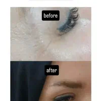 تخفیف بوتاکس و ژل|خدمات آرایشگری و زیبایی|دورود, |دیوار