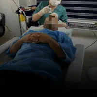 کاشت مو اقساط بلندمدت باگارانتی مادام العمر