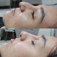 آف ویژه فیلر|خدمات آرایشگری و زیبایی|مشهد, شهید آوینی|دیوار