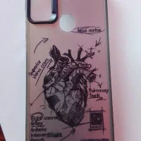 گارد گوشی a11