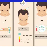 خدمات زیبایی درمنزلPRP دست صورت