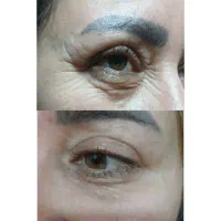 ژل لب 600|خدمات آرایشگری و زیبایی|ماهدشت, |دیوار