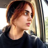 زیبایی بینی فقط با ۴۰ تومن