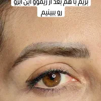 ریموو ریمو پاک کردن تتو تاتو پاک کردن|خدمات آرایشگری و زیبایی|شاهینشهر, عطار|دیوار