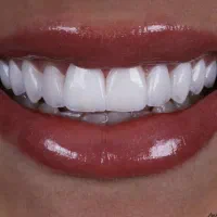 دندانپزشکی اقساطی با وام قرض الحسنه|خدمات آرایشگری و زیبایی|اصفهان, لاله|دیوار