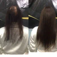 موی اکستنشن (فروش و نصب رایگان) با موی اکستیشن۳۶۰۰