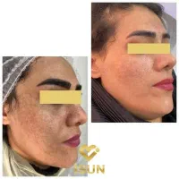نیازمند مدل برای پاکسازی و فیشیال
