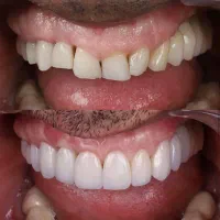 دندانپزشکی تخصصی،ایمپلنت،اوردنچر،ارتودنسی|خدمات آرایشگری و زیبایی|تبریز, |دیوار