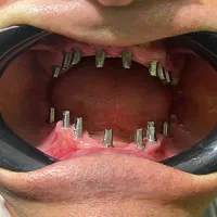 مطب دندانپزشکی|خدمات آرایشگری و زیبایی|تهران, یوسفآباد|دیوار